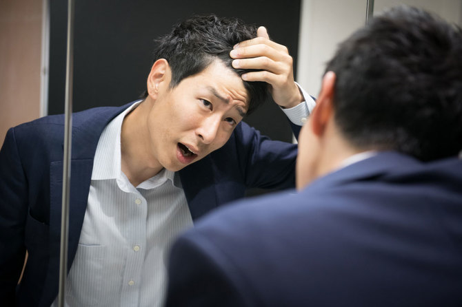 薄毛ではないのに気にする人が多い?