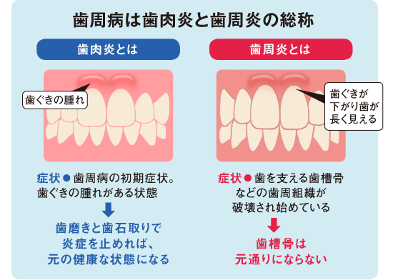 40代から歯は失われていく 今日から始める 正しいオーラルケア Dol Plus ダイヤモンド オンライン