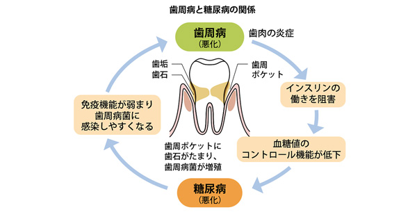 糖尿病とメタボの予備軍は要注意!口腔ケアが全身の健康につながる